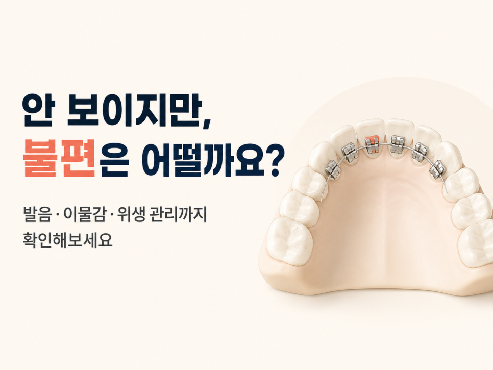 강남 설측교정 장단점, 발음과 위생 관리는 어떨까? 관련 이미지 1