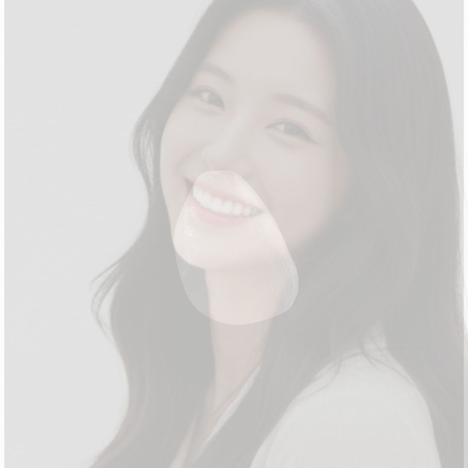 무삭제 라미네이트 후기 꼼꼼히 찾아봤어요 관련 이미지 16