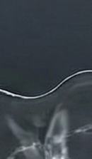 신사역치과 치아교정 전 꼭 확인해야 할 정밀 진단 기준 관련 이미지 29