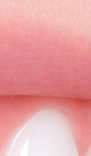 What to Check Before Choosing a Gangnam Laminate Dental Clinic image 26