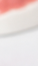 성인 돌출입 교정, 발치 없이도 변화가 가능할까? 관련 이미지 25