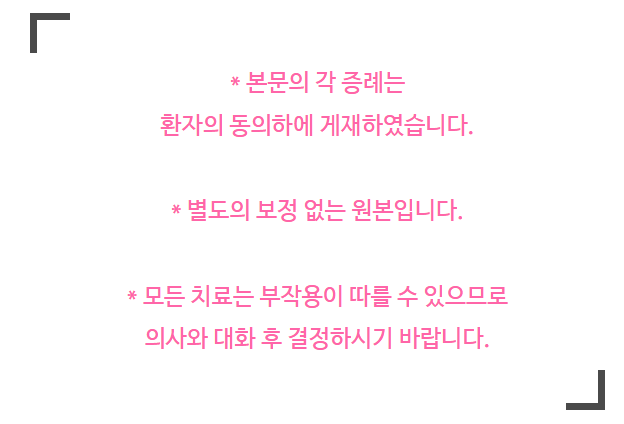 치아미백비용 아까워 셀프 미백했다가 후회하는 이유 관련 이미지 3