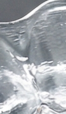 강남교정치과 선택 시 확인해야 할 핵심 기준과 정밀 진단 관련 이미지 31