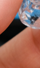 강남 교정전문의치과 고민된다면 관련 이미지 39