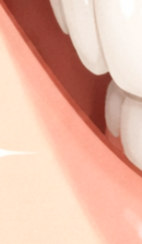 잠원역교정치과 선택 전 확인해야 할 의학적 진단 기준 관련 이미지 29