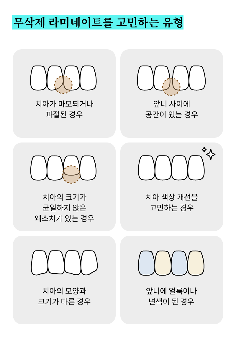 무삭제 라미네이트 시술 전 알아봐야 할 목록? 관련 이미지 15