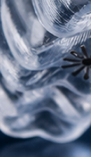 강남교정치과 결정 전 고려할 사항은 관련 이미지 40