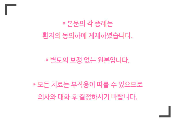 주걱턱 교정 VS 양악수술? 교정과 전문의가 답변드립니다 관련 이미지 9