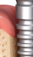 If You’re Considering a Seoul Implant Dental Clinic image 38