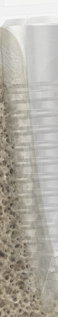 Invisalign Retainer Duration: A Detailed Look image 34