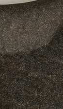 Systematic Examination Process to Review Before Deciding on Front Teeth Laminates image 49