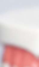 성인 돌출입 교정, 발치 없이도 변화가 가능할까? 관련 이미지 30