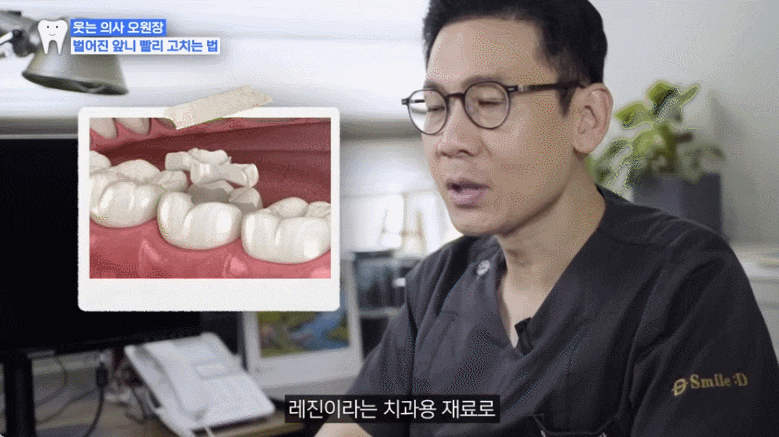 벌어진 앞니 레진 vs 교정? 딱 3분만 투자해서 10년 후회 막는 법 관련 이미지 3