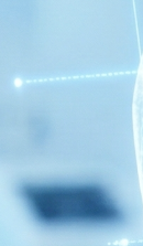 돌출입 교정 기간 줄일 수 있을까? 기간 단축을 돕는 핵심 요소 관련 이미지 30