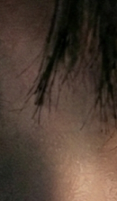 논현역교정치과 선택 전 반드시 확인해야 할 체크 포인트 관련 이미지 30