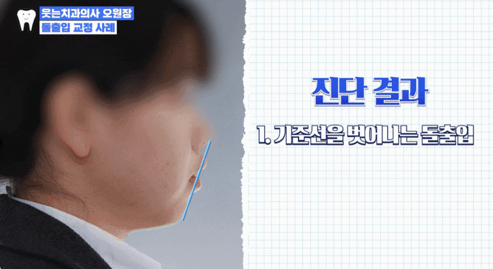 혹시 나도? 정확한 돌출입 교정치과 선택의 모든 것 관련 이미지 3