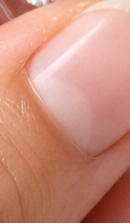 What to Consider Before Visiting a Seoul Orthodontic Clinic image 33