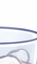 앞니 라미네이트 시술이 고민된다면 관련 이미지 38