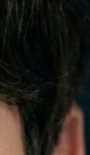 논현역교정치과 선택 전 반드시 확인해야 할 체크 포인트 관련 이미지 33