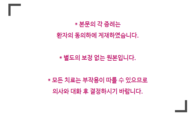 신사동치과 덧니부분교정 실패하기 싫다면 필독 관련 이미지 1
