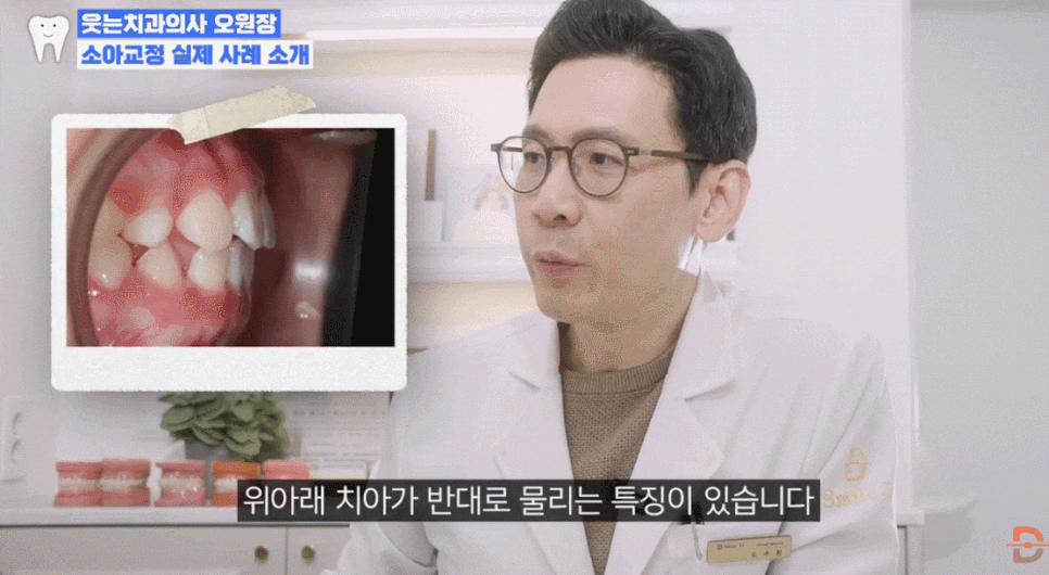 치아교정 시기별 추천 우리 아이 교정 골든타임 핵심 요약 관련 이미지 14