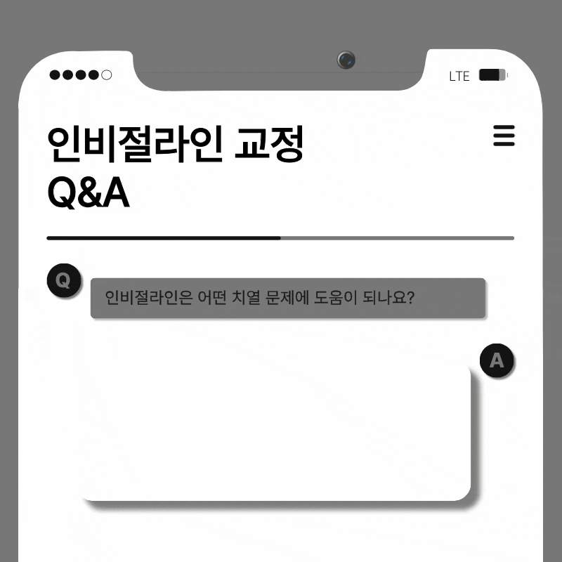 강남교정치과 결정 전 고려할 사항은 관련 이미지 7