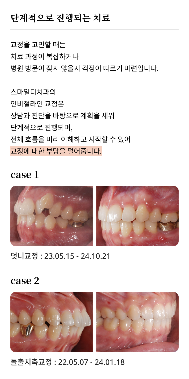 Gangnam Dental Clinic Orthodontics: Is Treatment Possible for Adults? image 18