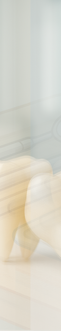 무삭제 라미네이트 추천 시작부터 결정까지 정리 관련 이미지 20