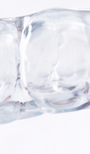 강남 인비절라인 치과 찾고 있다면 관련 이미지 30