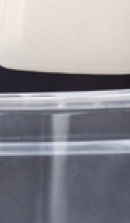 40대 치아 교정 고민 중이라면? 부담 줄이고 효율 높이는 선택법 관련 이미지 32