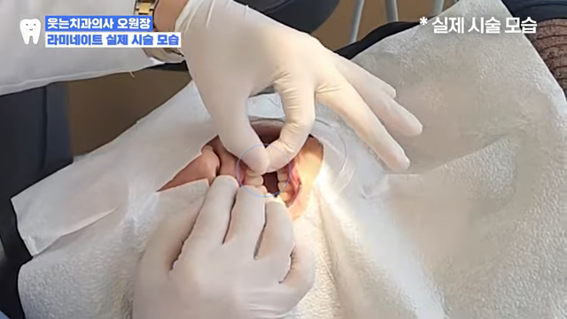 앞니 라미네이트 가격 00만 원? 진짜 중요한 건 따로 있어요 관련 이미지 4