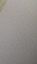 강남무삭제라미네이트치과 선택을 위한 정밀 정보 관련 이미지 40