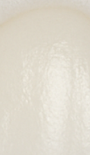 앞니 벌어짐 치료 전 반드시 체크해야 할 것들 정리 관련 이미지 31