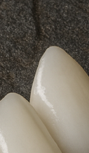 Systematic Examination Process to Review Before Deciding on Front Teeth Laminates image 30