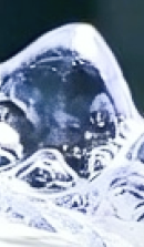 강남 임플란트 치과 초기 단계의 정밀한 분석이 중요한 이유 관련 이미지 31