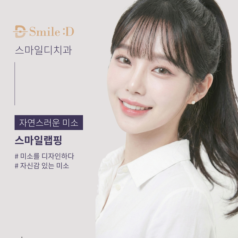 앞니 벌어짐 치료 전 반드시 체크해야 할 것들 정리 관련 이미지 9