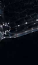 If You Are Considering Recommendations for Invisalign Dental Clinics in Seoul image 38