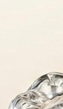 Gangnam Dental Clinic Orthodontics: Is Treatment Possible for Adults? image 31