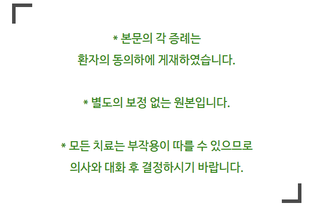 벌어진 앞니교정 부분교정으로 돈과 시간 날리기 싫다면 필독 관련 이미지 1