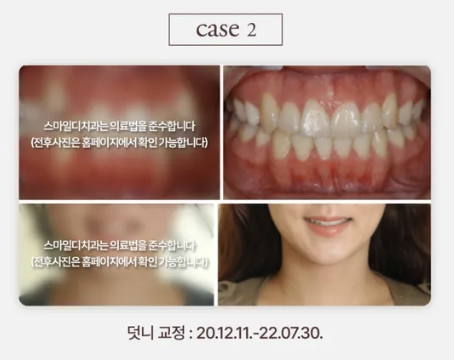 [안내] 스마일디치과의원입니다 관련 이미지 3