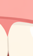 신사역 치과 추천 찾아본다면 관련 이미지 30