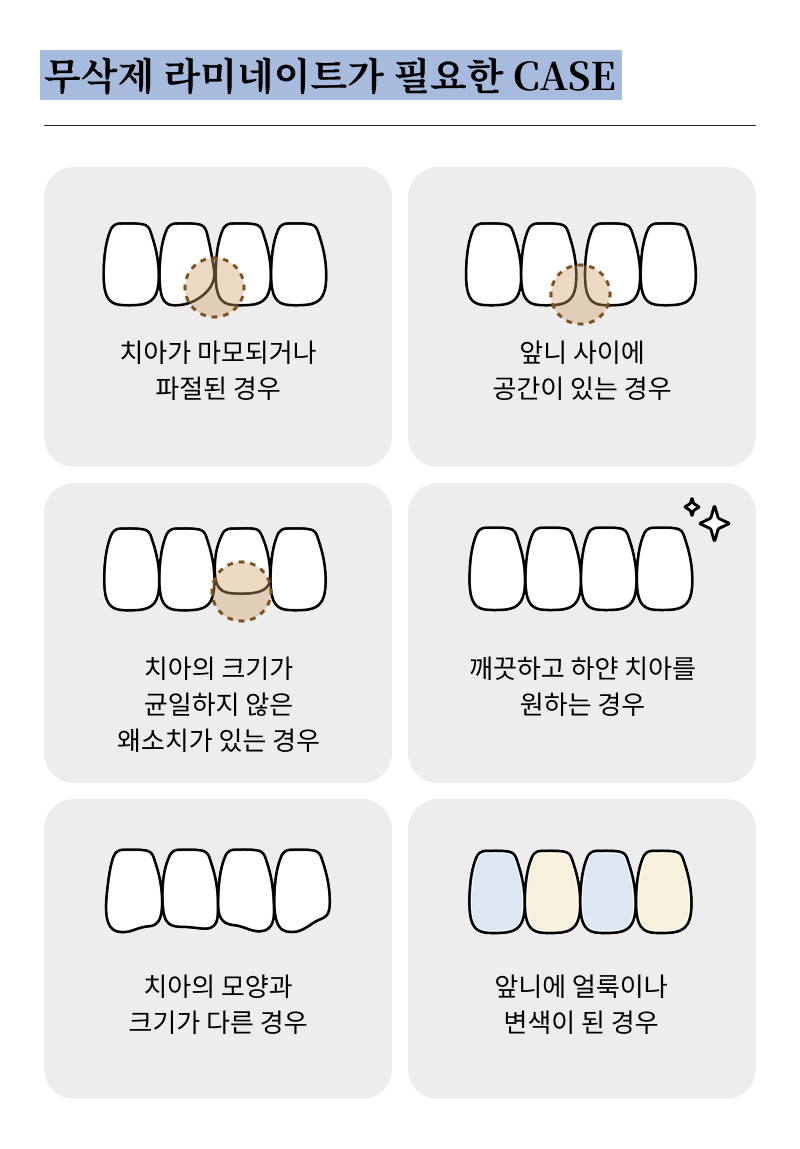 앞니 벌어짐 치료 전 반드시 체크해야 할 것들 정리 관련 이미지 15