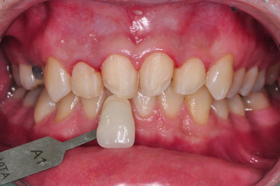 선릉역치과 관련 이미지 6