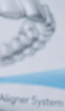 압구정치과 고민 중이라면 관련 이미지 31