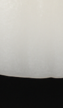 앞니 벌어짐 치료 전 반드시 체크해야 할 것들 정리 관련 이미지 38