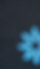 성인 돌출입 교정, 발치 없이도 변화가 가능할까? 관련 이미지 26