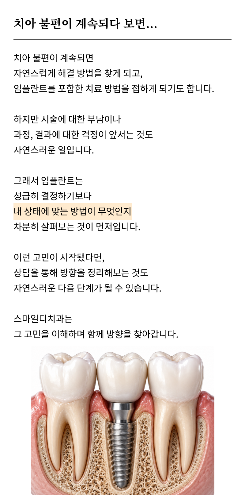 서울치과추천 고민하고 있다면 관련 이미지 9