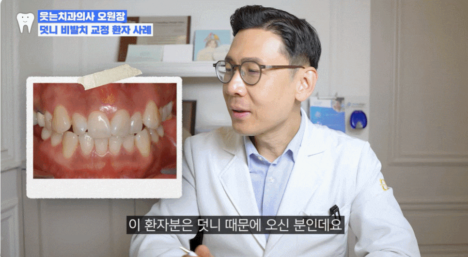 Crooked Teeth Correction? Cases Possible With Partial Orthodontics or Without Extraction image 1