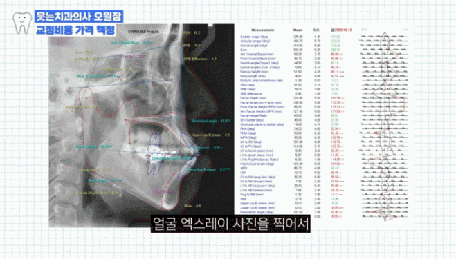 내근처치과라서 갔는데 교정은 별로? 교정치과 제대로 고르는 방법은 관련 이미지 9