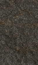 Systematic Examination Process to Review Before Deciding on Front Teeth Laminates image 35